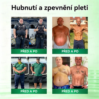 Oficiální obchod  |🍧𝗟𝘂𝘅𝗮𝗿𝗶𝘀𝗲® MORINGA X BERBERIN  10-IN-1 Pokročilý Nano Mikrojehly Náplast(Jedna náplast denně, viditelné změny již za 7 dní) ✅ Pomáhá při obezitě, cukrovce, spánkové apnoe, problémech s klouby a dalších potížích👩‍⚕️