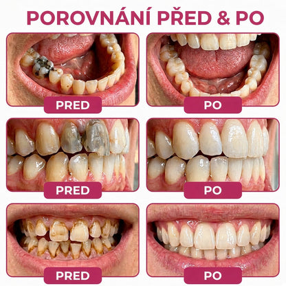 🛡️ 𝐓𝐫𝐢𝐥𝐮𝐦𝐢𝐚® 𝐃𝐞𝐧𝐏𝐞𝐫𝐦🦷 – 𝐆𝐞𝐥 𝐧𝐚 𝐨𝐛𝐧𝐨𝐯𝐮 𝐳𝐮𝐛𝐧í𝐡𝐨 𝐤𝐚𝐳𝐮 𝐚 𝐩ř𝐢𝐫𝐨𝐳𝐞𝐧𝐨𝐮 𝐫𝐞𝐦𝐢𝐧𝐞𝐫𝐚𝐥𝐢𝐳𝐚𝐜𝐢 𝐳𝐮𝐛𝐧í 𝐬𝐤𝐥𝐨𝐯𝐢𝐧𝐲🍚