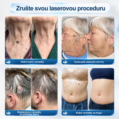 🥑𝐎𝐟𝐢𝐜𝐢á𝐥𝐧í 𝐳𝐧𝐚č𝐤𝐨𝐯á 𝐩𝐫𝐨𝐝𝐞𝐣𝐧𝐚  𝐏𝐢𝐜𝐝𝐨® 𝟕𝐝𝐞𝐧𝐧í 𝐨𝐝𝐬𝐭𝐫𝐚ň𝐨𝐯𝐚č   𝐤𝐨ž𝐧í𝐜𝐡 𝐯ý𝐫ů𝐬𝐭𝐤ů 𝐚 𝐬𝐤𝐯𝐫𝐧(Nulová bolest, nulová kulička Rollerball)