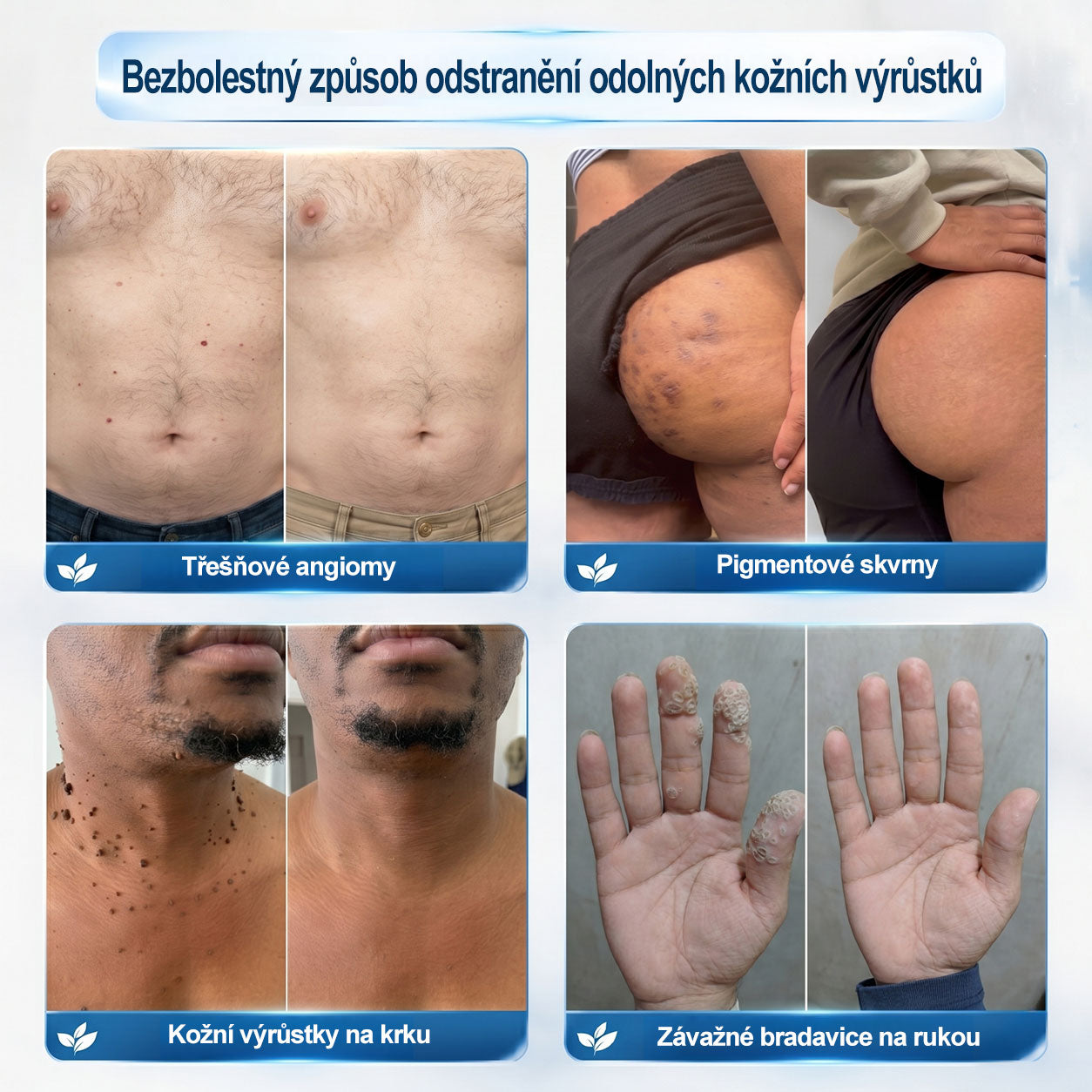 🥑𝐎𝐟𝐢𝐜𝐢á𝐥𝐧í 𝐳𝐧𝐚č𝐤𝐨𝐯á 𝐩𝐫𝐨𝐝𝐞𝐣𝐧𝐚  𝐏𝐢𝐜𝐝𝐨® 𝟕𝐝𝐞𝐧𝐧í 𝐨𝐝𝐬𝐭𝐫𝐚ň𝐨𝐯𝐚č   𝐤𝐨ž𝐧í𝐜𝐡 𝐯ý𝐫ů𝐬𝐭𝐤ů 𝐚 𝐬𝐤𝐯𝐫𝐧(Nulová bolest, nulová kulička Rollerball)