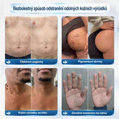 🥑𝐎𝐟𝐢𝐜𝐢á𝐥𝐧í 𝐳𝐧𝐚č𝐤𝐨𝐯á 𝐩𝐫𝐨𝐝𝐞𝐣𝐧𝐚  𝐏𝐢𝐜𝐝𝐨® 𝟕𝐝𝐞𝐧𝐧í 𝐨𝐝𝐬𝐭𝐫𝐚ň𝐨𝐯𝐚č   𝐤𝐨ž𝐧í𝐜𝐡 𝐯ý𝐫ů𝐬𝐭𝐤ů 𝐚 𝐬𝐤𝐯𝐫𝐧(Nulová bolest, nulová kulička Rollerball)