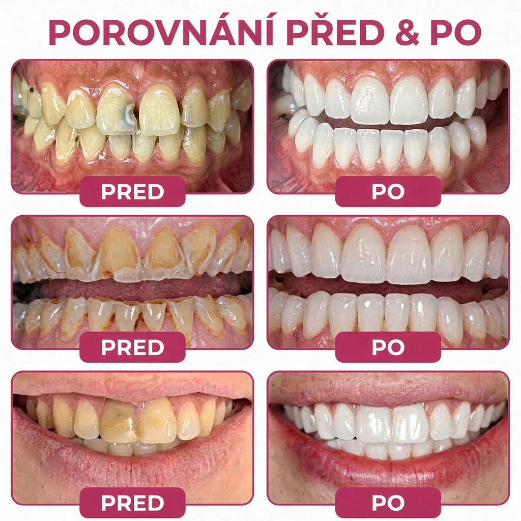 🛡️ 𝐓𝐫𝐢𝐥𝐮𝐦𝐢𝐚® 𝐃𝐞𝐧𝐏𝐞𝐫𝐦🦷 – 𝐆𝐞𝐥 𝐧𝐚 𝐨𝐛𝐧𝐨𝐯𝐮 𝐳𝐮𝐛𝐧í𝐡𝐨 𝐤𝐚𝐳𝐮 𝐚 𝐩ř𝐢𝐫𝐨𝐳𝐞𝐧𝐨𝐮 𝐫𝐞𝐦𝐢𝐧𝐞𝐫𝐚𝐥𝐢𝐳𝐚𝐜𝐢 𝐳𝐮𝐛𝐧í 𝐬𝐤𝐥𝐨𝐯𝐢𝐧𝐲🍚