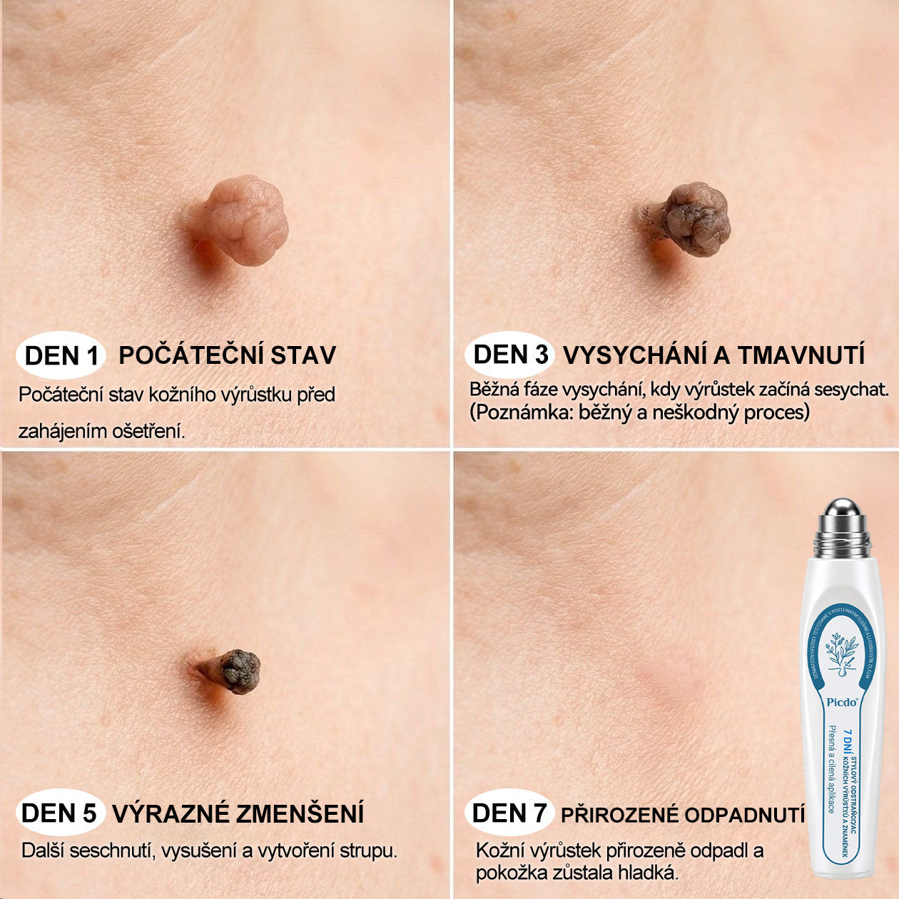 🥑𝐎𝐟𝐢𝐜𝐢á𝐥𝐧í 𝐳𝐧𝐚č𝐤𝐨𝐯á 𝐩𝐫𝐨𝐝𝐞𝐣𝐧𝐚  𝐏𝐢𝐜𝐝𝐨® 𝟕𝐝𝐞𝐧𝐧í 𝐨𝐝𝐬𝐭𝐫𝐚ň𝐨𝐯𝐚č   𝐤𝐨ž𝐧í𝐜𝐡 𝐯ý𝐫ů𝐬𝐭𝐤ů 𝐚 𝐬𝐤𝐯𝐫𝐧(Nulová bolest, nulová kulička Rollerball)