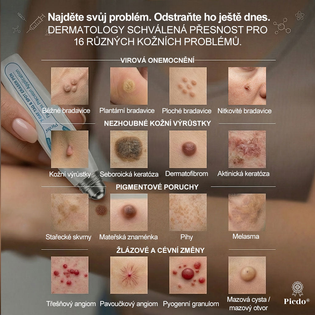 🥑𝐎𝐟𝐢𝐜𝐢á𝐥𝐧í 𝐳𝐧𝐚č𝐤𝐨𝐯á 𝐩𝐫𝐨𝐝𝐞𝐣𝐧𝐚  𝐏𝐢𝐜𝐝𝐨® 𝟕𝐝𝐞𝐧𝐧í 𝐨𝐝𝐬𝐭𝐫𝐚ň𝐨𝐯𝐚č   𝐤𝐨ž𝐧í𝐜𝐡 𝐯ý𝐫ů𝐬𝐭𝐤ů 𝐚 𝐬𝐤𝐯𝐫𝐧(Nulová bolest, nulová kulička Rollerball)