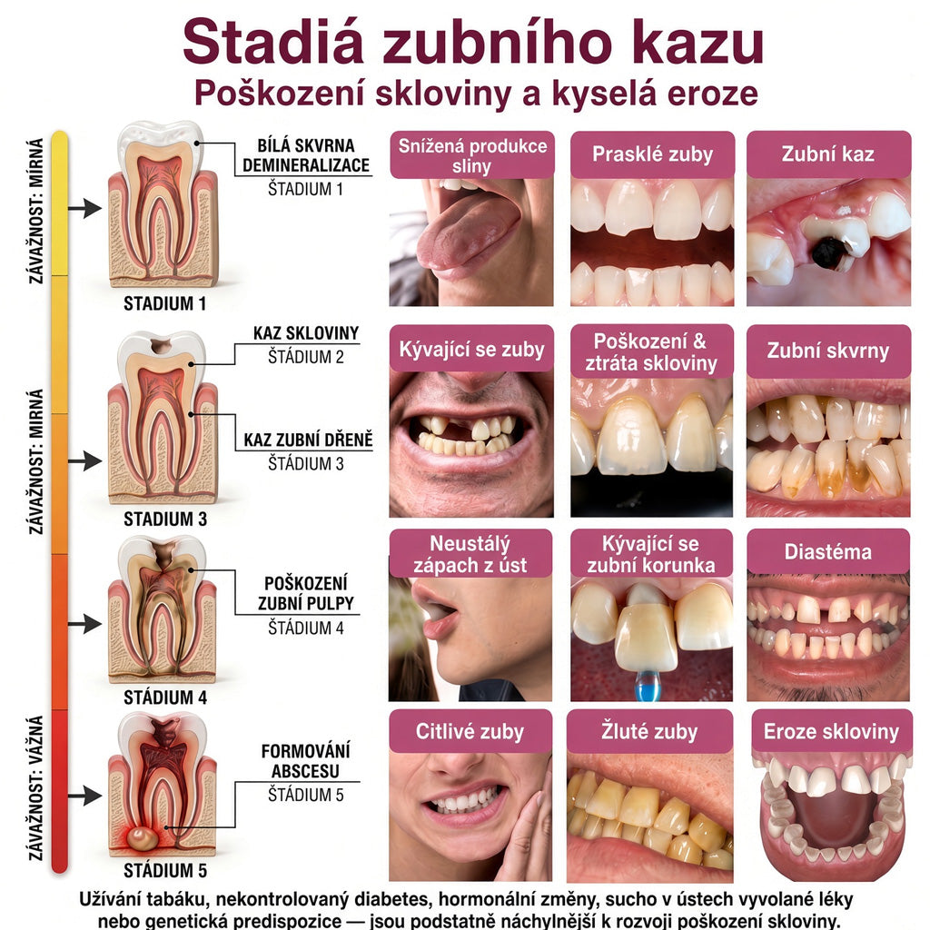 🛡️ 𝐓𝐫𝐢𝐥𝐮𝐦𝐢𝐚® 𝐃𝐞𝐧𝐏𝐞𝐫𝐦🦷 – 𝐆𝐞𝐥 𝐧𝐚 𝐨𝐛𝐧𝐨𝐯𝐮 𝐳𝐮𝐛𝐧í𝐡𝐨 𝐤𝐚𝐳𝐮 𝐚 𝐩ř𝐢𝐫𝐨𝐳𝐞𝐧𝐨𝐮 𝐫𝐞𝐦𝐢𝐧𝐞𝐫𝐚𝐥𝐢𝐳𝐚𝐜𝐢 𝐳𝐮𝐛𝐧í 𝐬𝐤𝐥𝐨𝐯𝐢𝐧𝐲🍚