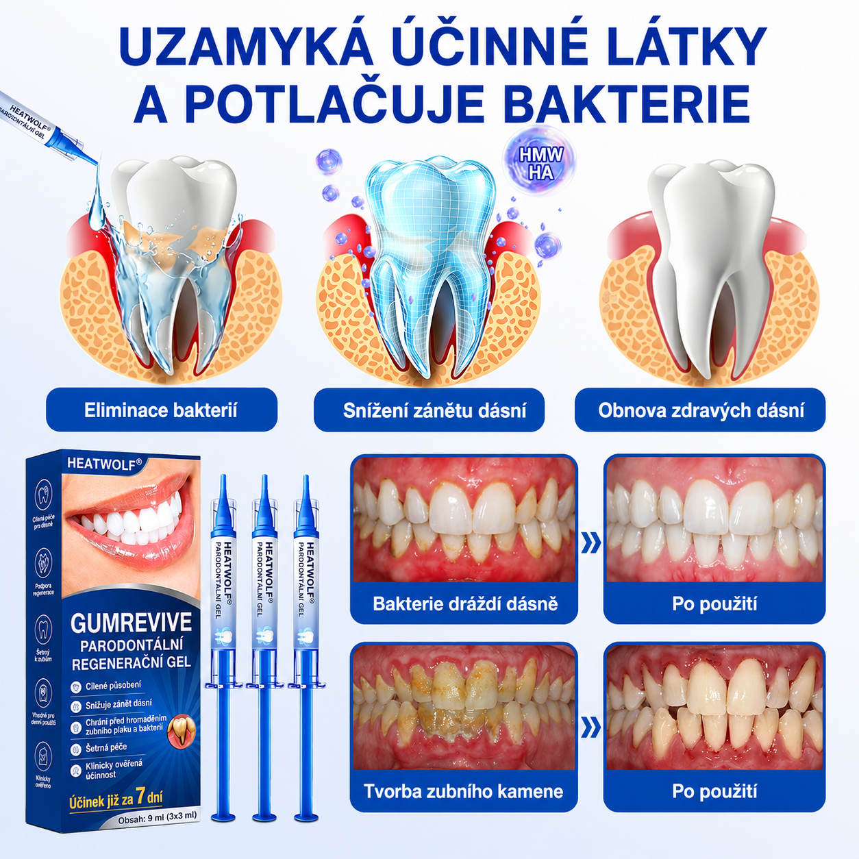 🇨🇿 HEATWOLF® 🦷 GumRevive parodontální opravný gel 🎃