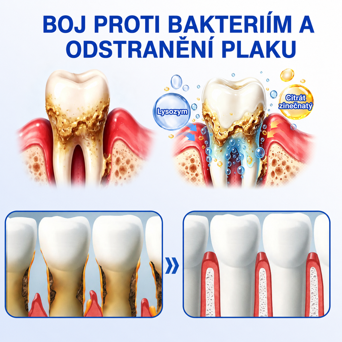 🇨🇿 HEATWOLF® 🦷 GumRevive parodontální opravný gel 🎃