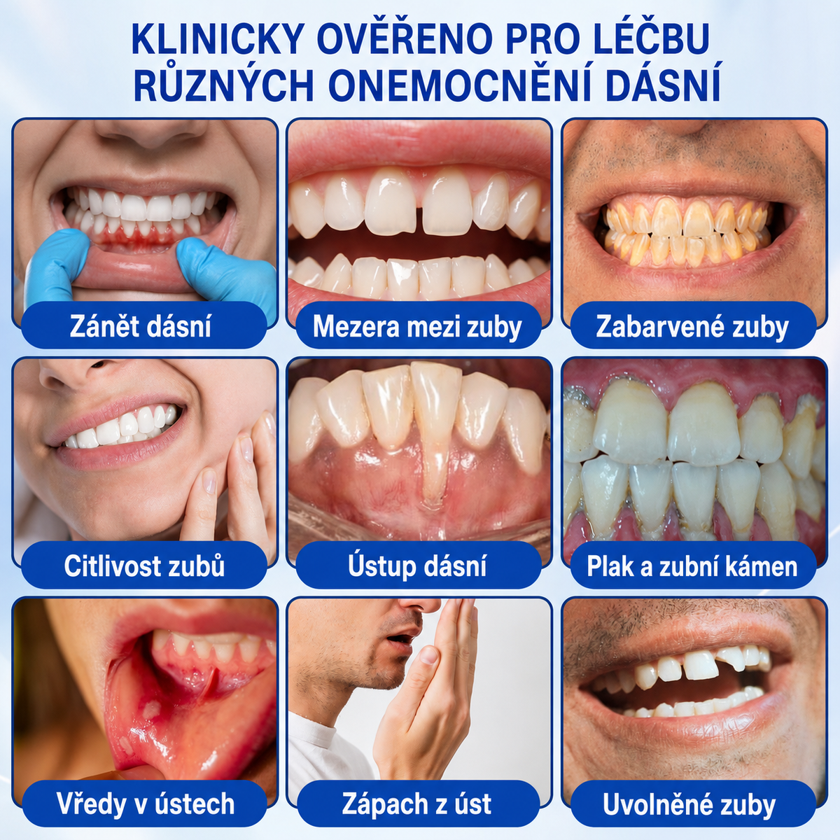 🇨🇿 HEATWOLF® 🦷 GumRevive parodontální opravný gel 🎃
