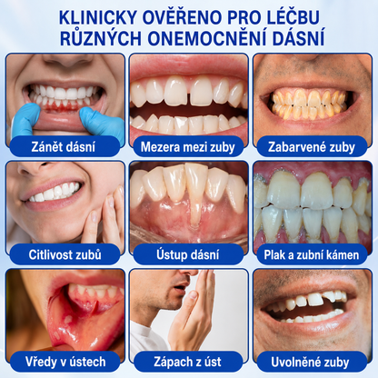 🇨🇿 HEATWOLF® 🦷 GumRevive parodontální opravný gel 🎃